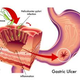 Illustration for article titled Obat Maag Dalam Al Quranem/em